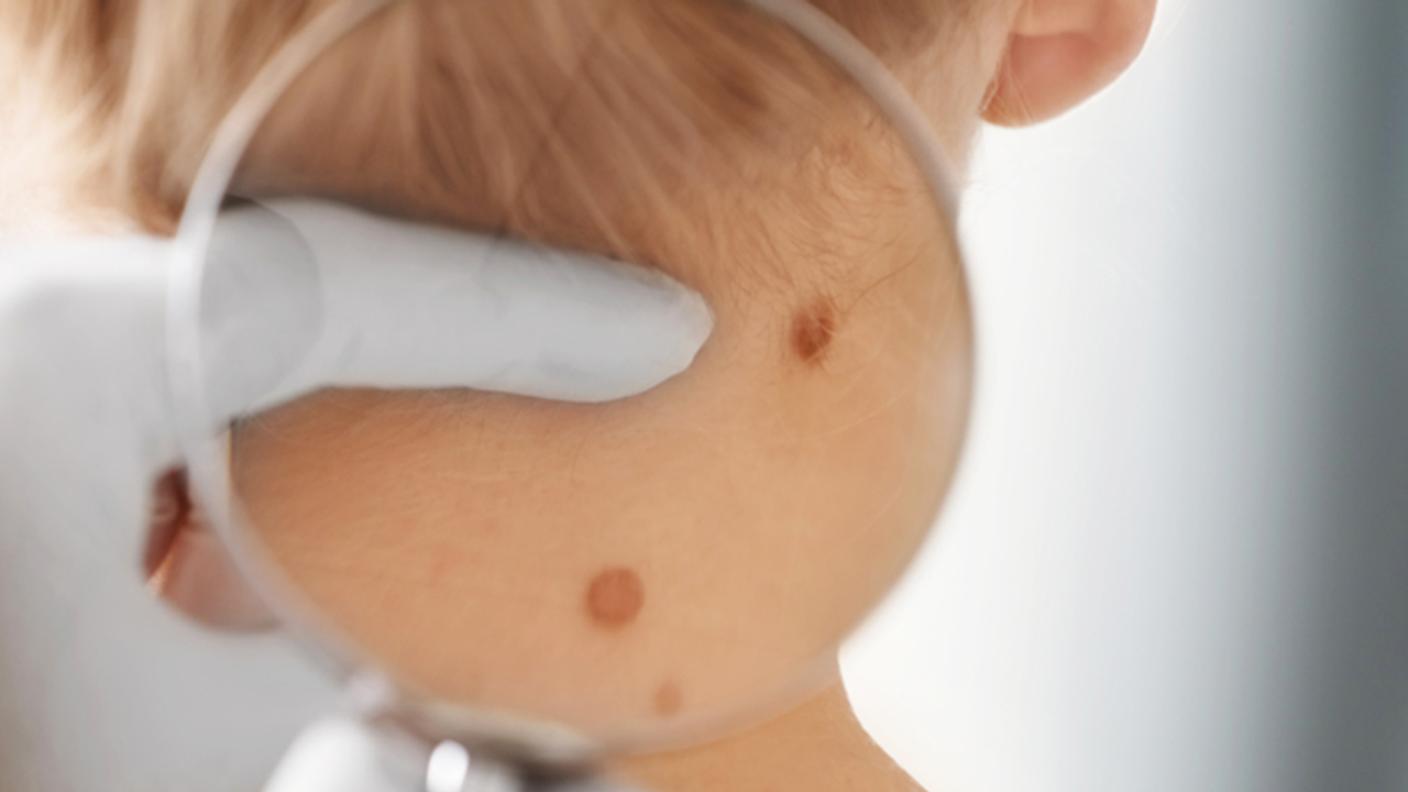 Cildimizden gelen 5 önemli sinyal, ciddi hastalıkların ilk belirtisi olabilir