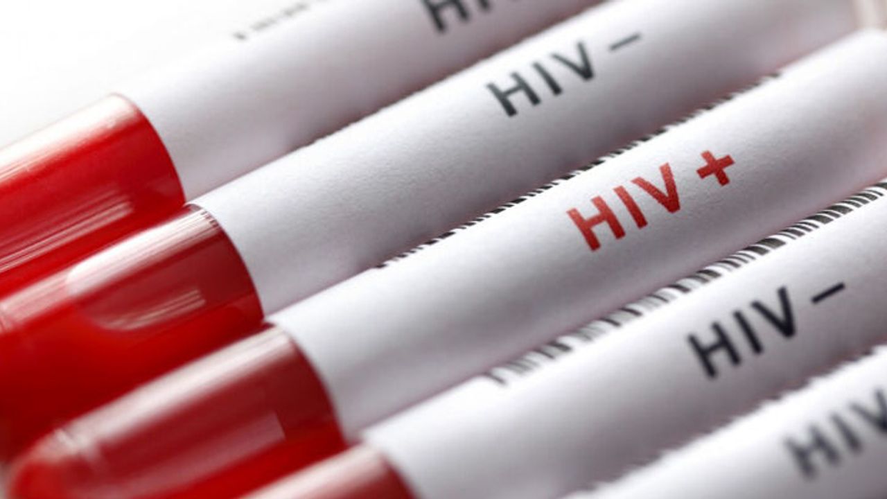 'HIV ahlaki değil, tıbbi bir durumdur’