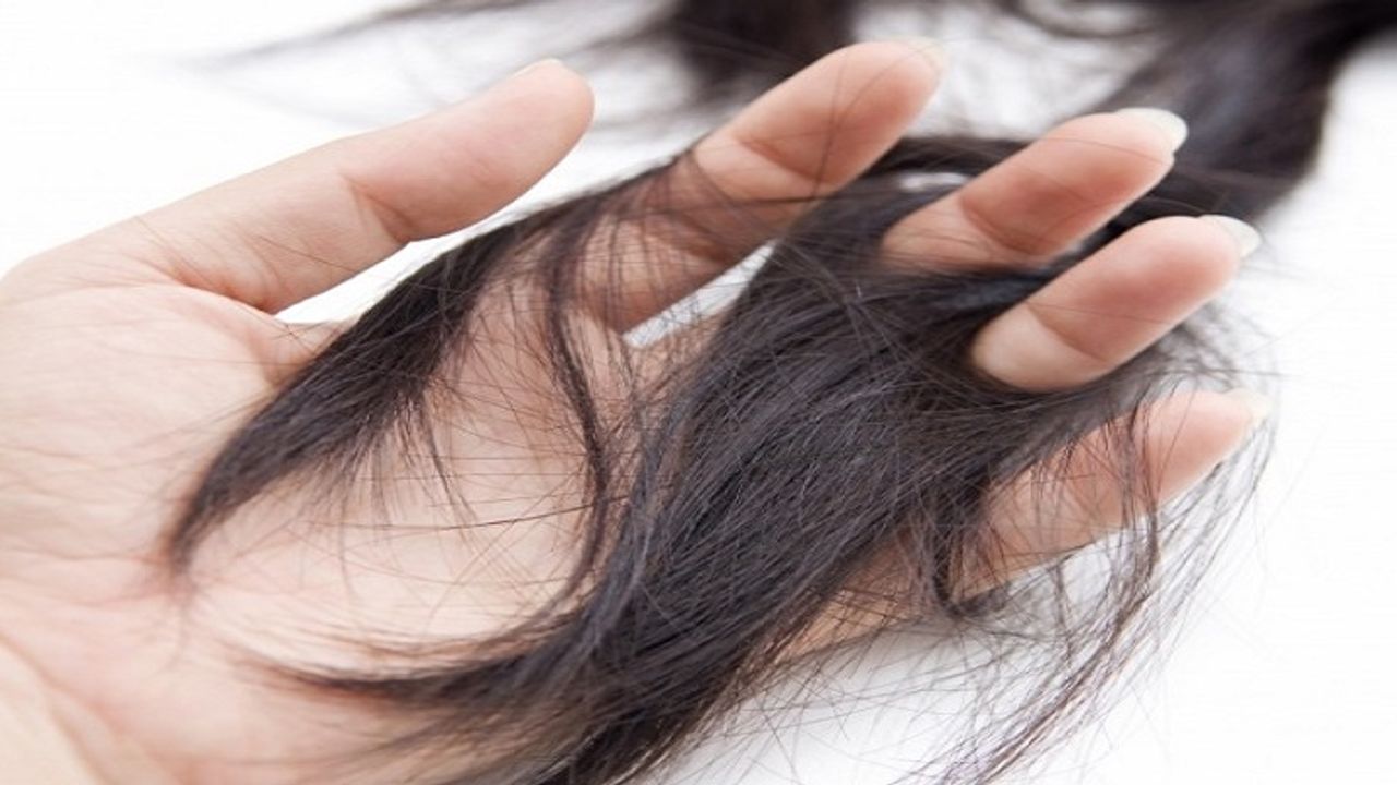 Saç Sağlığınıza Yenilik Getirin Ankara Saç Kök Hücre Hizmetleri