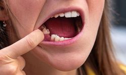 Diş kaybı yalnızca estetik bir sorun değil!
