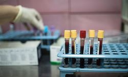 Türkiye'nin kanser haritası çıkarıldı: İstanbul ilk 10'da, zirvede Ağrı var