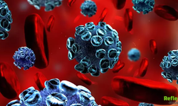 Kanda Enfeksiyon Nasıl Başlar Hangi Durumlarda Ortaya Çıkar