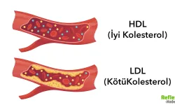 Kolesterol Neden Yükselir İşte En Yaygın Nedenler
