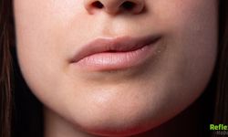 Yüz Felci Belirtileri Nelerdir Ne Zaman Hastaneye Gidilmeli