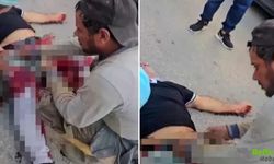 Antalya’da Borç Tartışması Kanlı Bitti İş İnsanı Pompalı Tüfekle Vuruldu