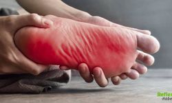Ayak Altı Yanması Neden Olur? Ne İyi Gelir?