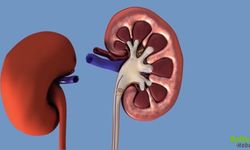 Böbrek Stenti Sonrası Bu Belirtilere Dikkat