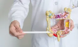 Kolon Kanseri Kimlerde Daha Sık Görülür? İşte Risk Faktörleri