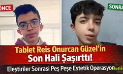 Tablet Reis Onurcan Güzel’in Son Hali Şaşırttı! Eleştiriler Sonrası Peş Peşe Estetik Operasyon