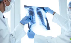 Zatürre Belirtileri Nelerdir Hangi Durumda Hastaneye Gidilmeli