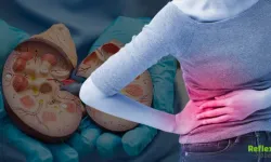 Böbrek Kanseri Sessiz İlerliyor Erken Tanı Hayat Kurtarıyor