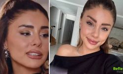 Samar Dadgar Kimdir, Estetik Yaptırdı Mı?
