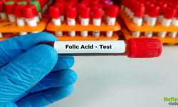 Folik Asit Kullananların Sayısı Artıyor! Sebebi Dikkat Çekti