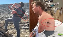 Gövdesini Delen Trekking Sopasıyla 16 Kilometre Yürüdü: Hayata Tutundu