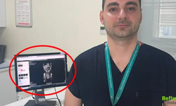 Zayıflamak İçin Yaptığı Şey Hayatını Kabusa Çevirdi! Midesinden Diş Fırçası Çıktı