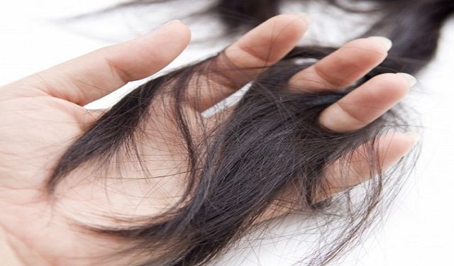 Saç Sağlığınıza Yenilik Getirin Ankara Saç Kök Hücre Hizmetleri