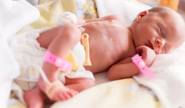 Her yıl yaklaşık 150 bin bebek prematüre doğuyor