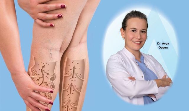 Varise karşı ne yapmalı? 8 etkili yöntem