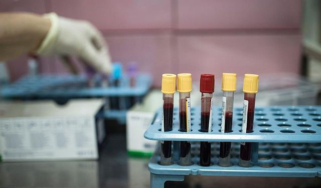 Türkiye'nin kanser haritası çıkarıldı: İstanbul ilk 10'da, zirvede Ağrı var