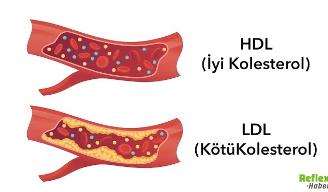 Kolesterol Neden Yükselir İşte En Yaygın Nedenler