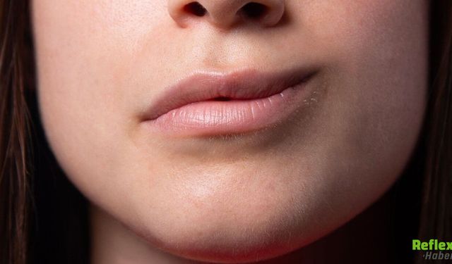 Yüz Felci Belirtileri Nelerdir Ne Zaman Hastaneye Gidilmeli