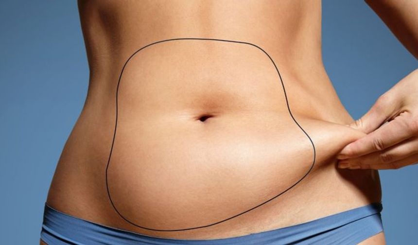 Gergin Bir Karın Bölgesi İçin Karın Germe Ameliyatı