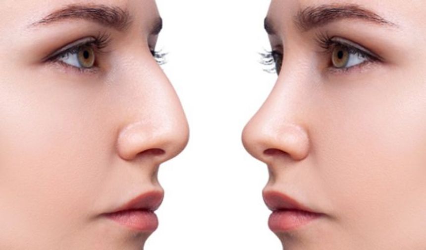 Burun Kemiği Aldırma