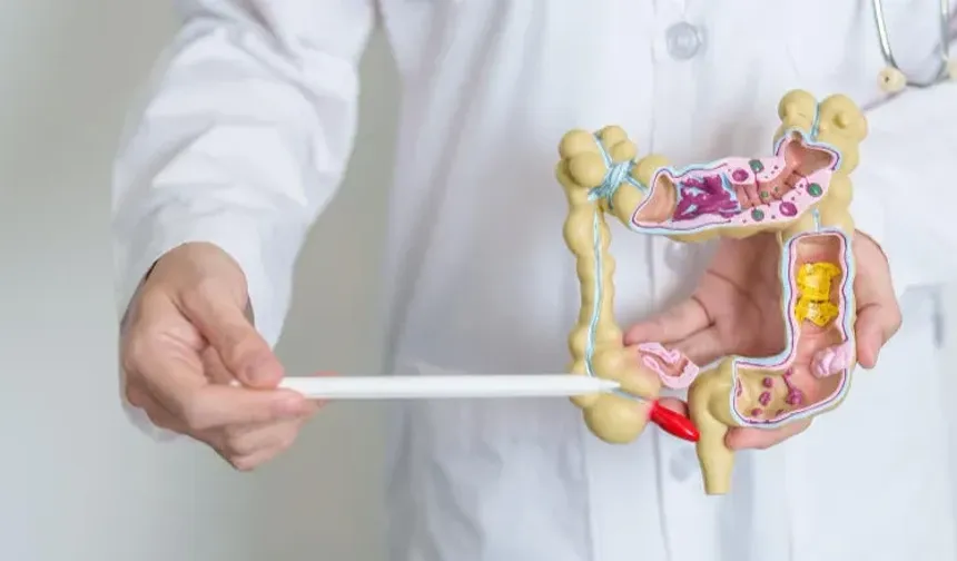 Kolon Kanseri Kimlerde Daha Sık Görülür? İşte Risk Faktörleri