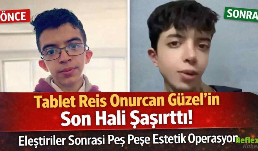 Tablet Reis Onurcan Güzel’in Son Hali Şaşırttı! Eleştiriler Sonrası Peş Peşe Estetik Operasyon