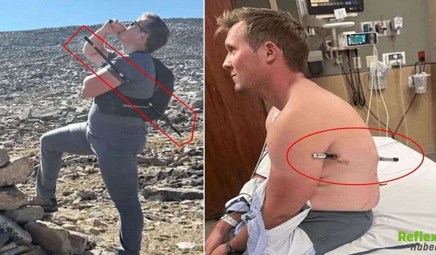 Gövdesini Delen Trekking Sopasıyla 16 Kilometre Yürüdü: Hayata Tutundu