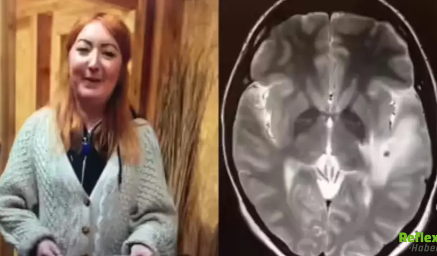 Hindistan Seyahati Hayatını Değiştirdi! Beyninde 38 Parazit Tespit Edildi